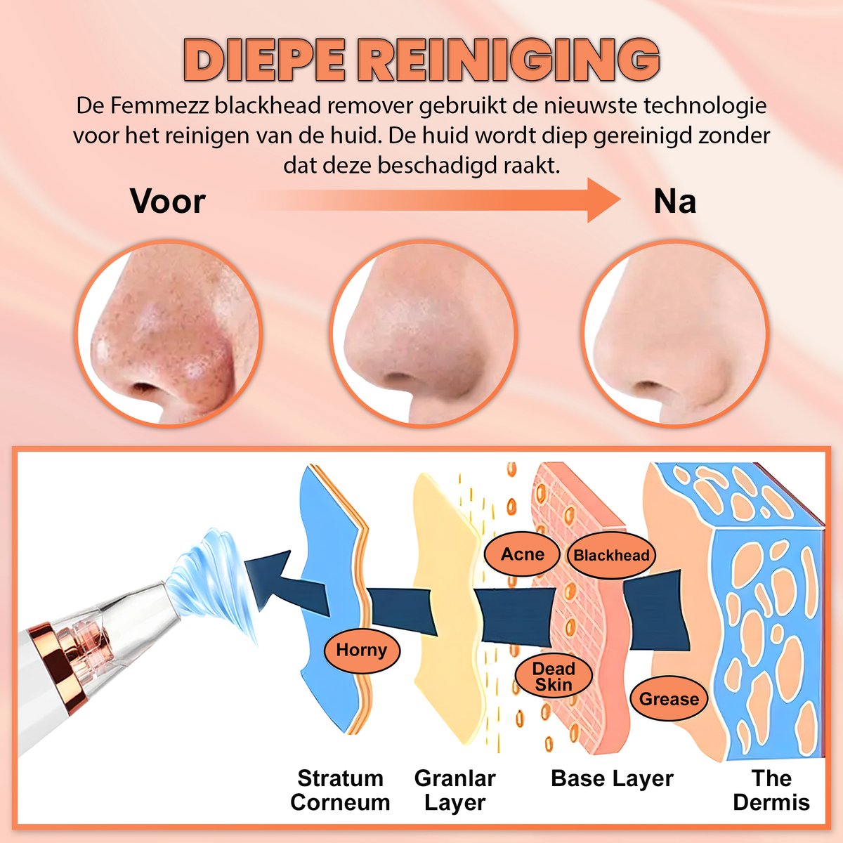 TibaGoods Premium Blackhead Remover I Poriënreiniger met 6 Opzetstukken Mee eters verwijderen | Acne | Comedonenlepels | Huidverzorging