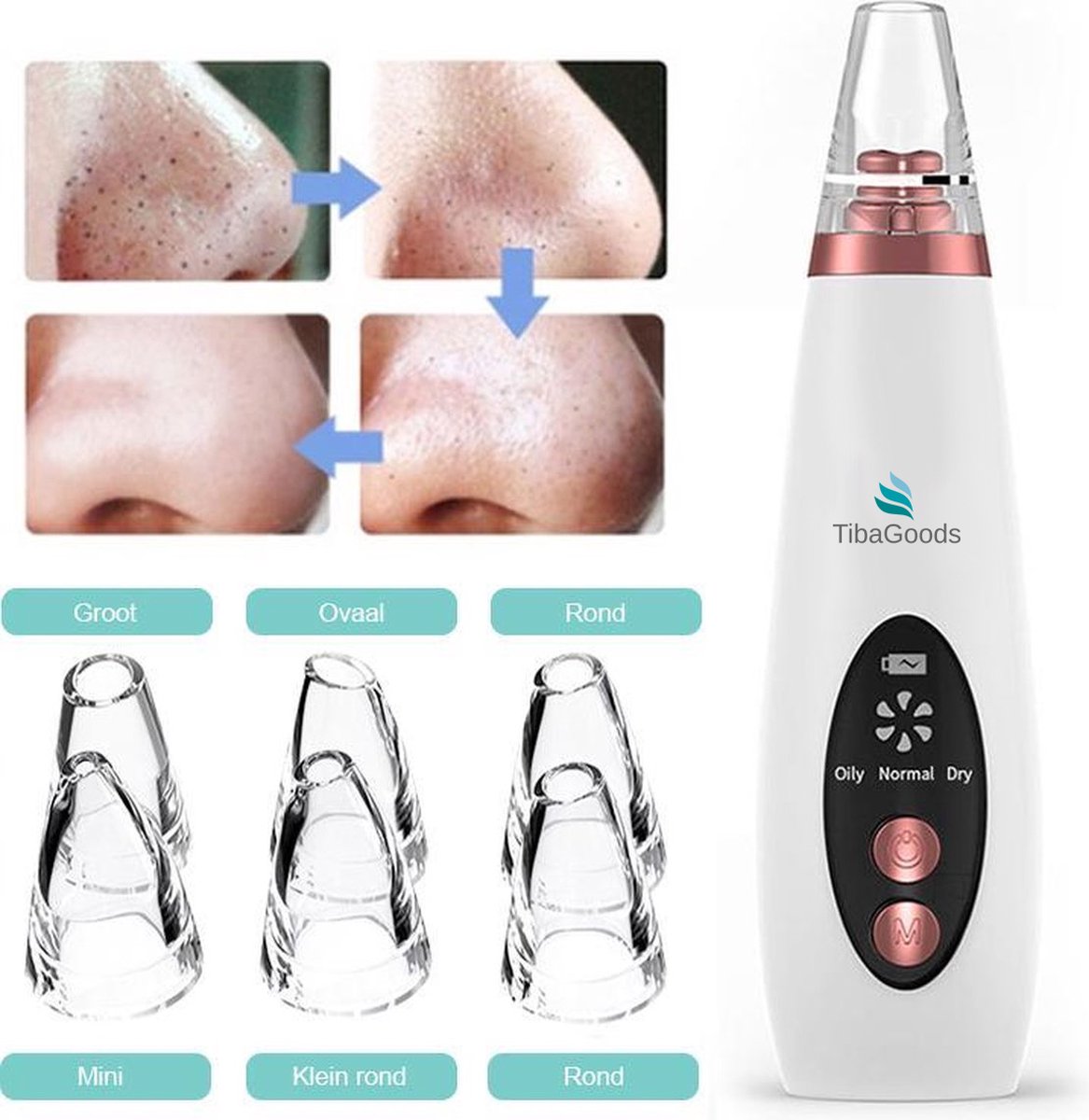 TibaGoods Premium Blackhead Remover I Poriënreiniger met 6 Opzetstukken Mee eters verwijderen | Acne | Comedonenlepels | Huidverzorging