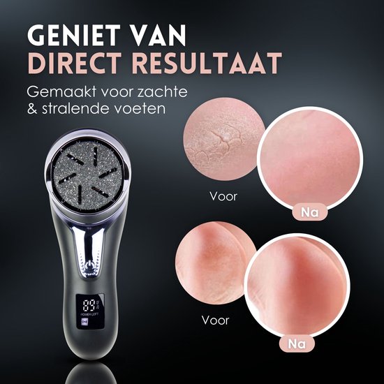 Beeperfect® Elektrische Eeltverwijderaar met Stofzuigsysteem - Voetvijl - Eeltvijl - IPX7 Waterdicht - Gratis Pedicure set - Inclusief 6 Eeltschijven - Zwart