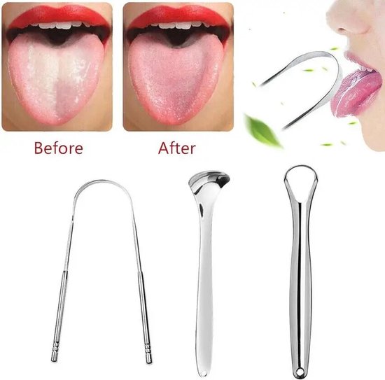Techvavo® Professionele Tongschraper 3-in-1 Set - Tongreiniger - Ultieme Mondverzorging voor een Frisse Adem