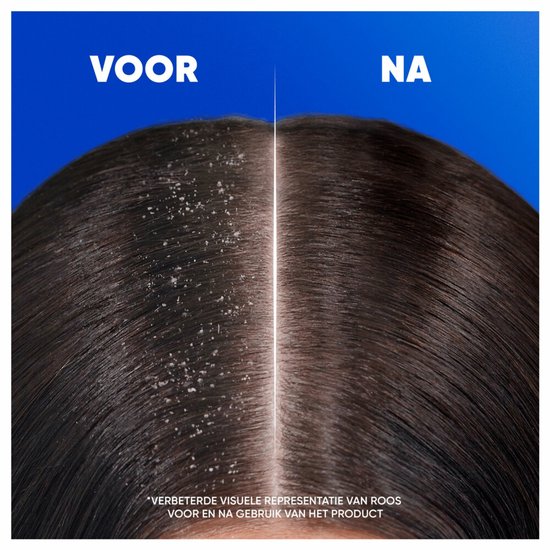 Head & Shoulders - Shampoo - Classic - 300ml