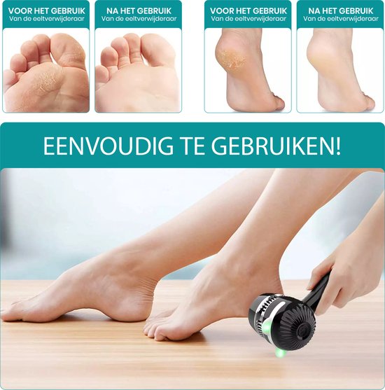 Apeiron Elektrische Eeltverwijderaar – Voetvijl – Professionele Eeltverwijderaar – Eeltvijl – Eeltverwijderaars - USB Oplaadbaar - Inclusief 3 Extra Vijlschijven - Wit - Gratis E-Book