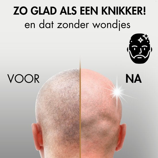 6-in-1 Scheerapparaat Mannen – Trimmer - Tondeuse - Sansbeauté® SkullSharp PRO - Electric Face & Head Shaver - Hoofd Kaal Scheren – Nat & Droog - Draadloos Opladen - Elektrisch