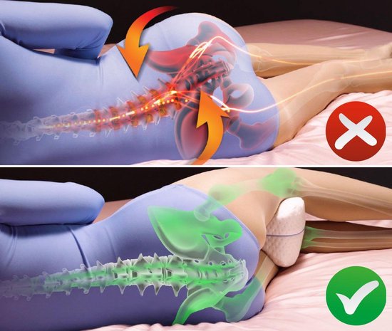 Dreamolino Leg Pillow|Ergonomisch knie- en beenkussen|Hoogwaardig memoryfoam|Creëert het optimale ligcomfort voor zijslapers|Voor meer comfort|Orthopedisch knie kussen