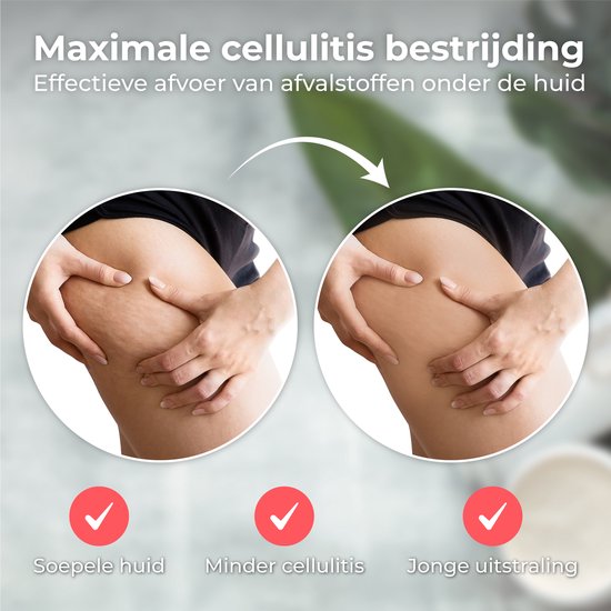 Nuvance - Elektrisch Cellulite Massage Apparaat - 12 Standen en Temperaturen - Volledig Lichaam - Cupping Cups Set Massage - Cellulite Cups - Hijama Cups - Anti Cellulitis