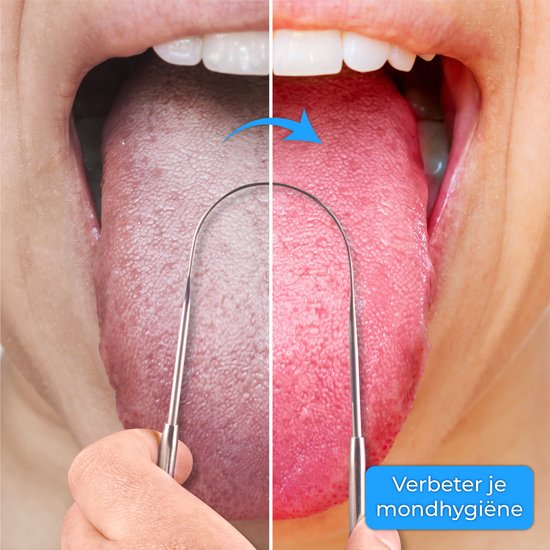 Nuvance - Professionele Tongschraper - 3 in 1 Set - voor Mondverzorging - Tongreiniger - Tong Schraper - Tongue Scraper - RVS
