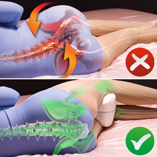 Dreamolino Leg Pillow|Ergonomisch knie- en beenkussen|Hoogwaardig memoryfoam|Creëert het optimale ligcomfort voor zijslapers|Voor meer comfort|Orthopedisch knie kussen