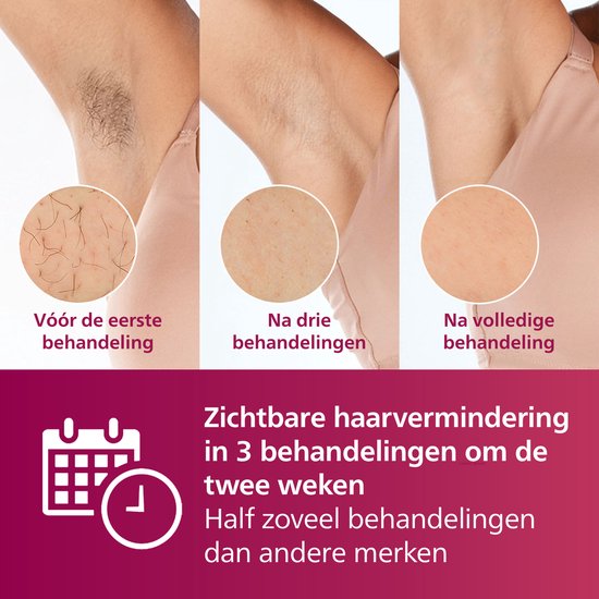 Philips Lumea IPL 7000 series - IPL Ontharingsapparaat - 2 opzetstukken met trimmer - BRI921/00