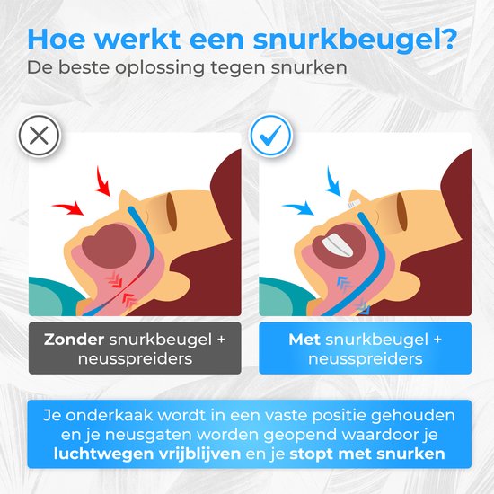 Nuvance - Anti Snurk Set - Anti Snurk Beugel - Neusspreiders - Neusclip - Snurkbeugel - Incl. eBook - Stop met Snurken - Betere Slaap