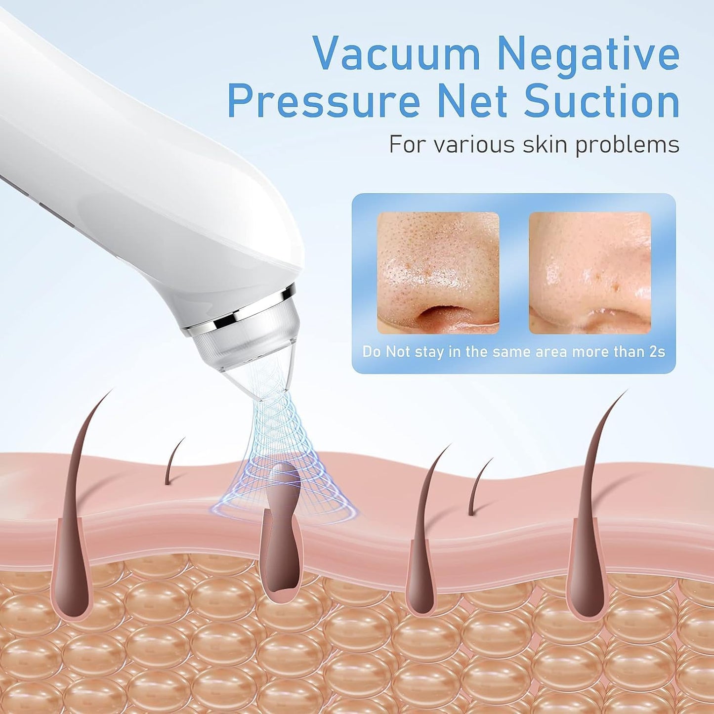 Ottleba Blackhead Remover Vacuum met 1080P HD-Camera – 17 × 4,5 × 4,5 cm – Lichtroze – Pore Cleaner met 3 Zuigstanden en 6 Opzetstukken