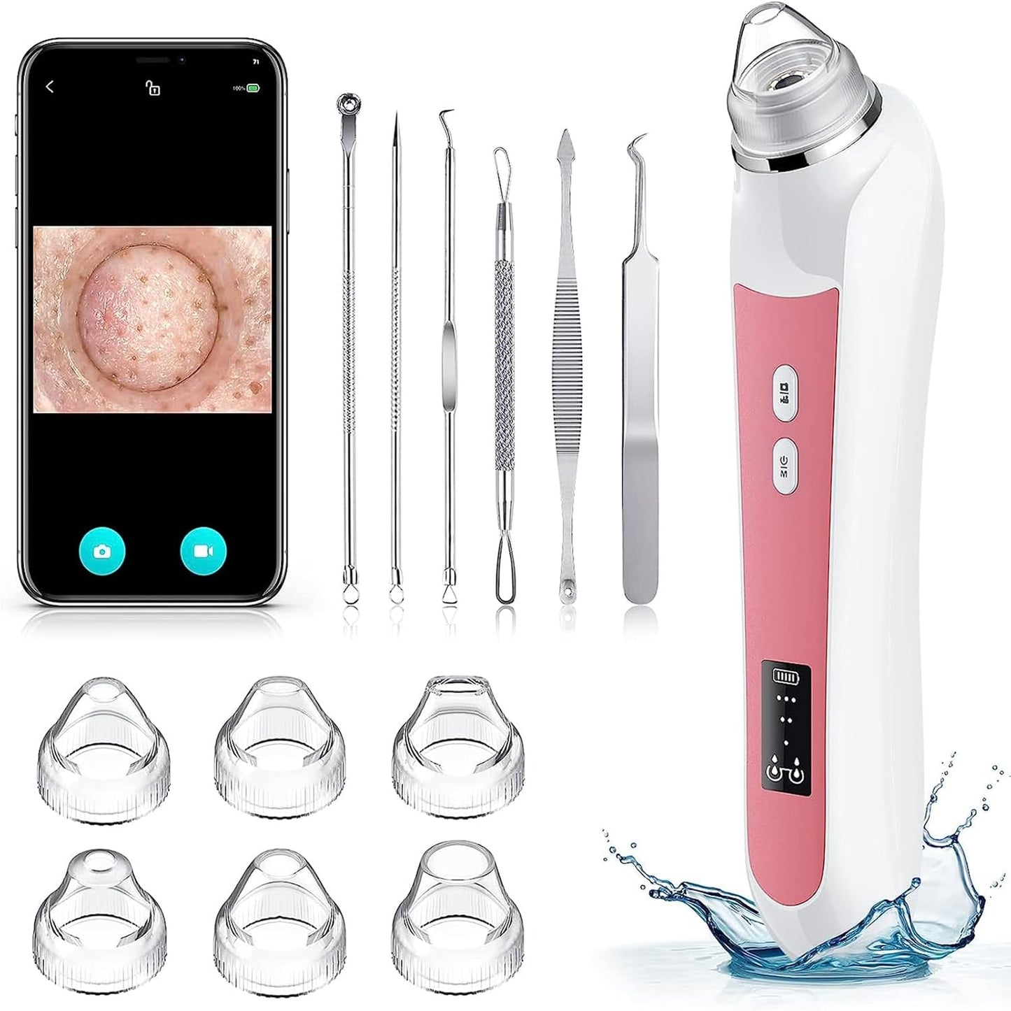 Ottleba Blackhead Remover Vacuum met 1080P HD-Camera – 17 × 4,5 × 4,5 cm – Lichtroze – Pore Cleaner met 3 Zuigstanden en 6 Opzetstukken