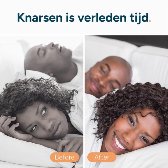 Nachtbeugel - Knarsbitje voor rechte tanden - Knarsbitje volwassenen - Bitje - Tandenknarsen