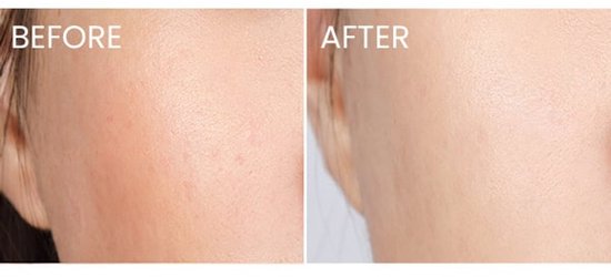 La Mer The Night Recovery Concentrate Cream - 7ml