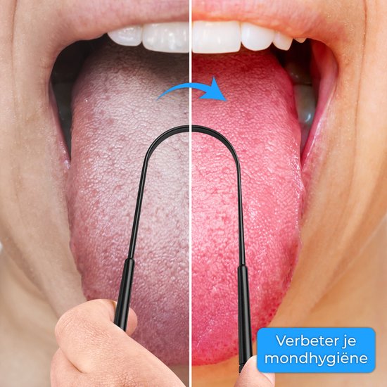 Nuvance Professionele Tongschraper - 3 in 1 Set - voor Mondverzorging - Tongreiniger - Tong Schraper - Tongue Scraper - RVS - Zwart
