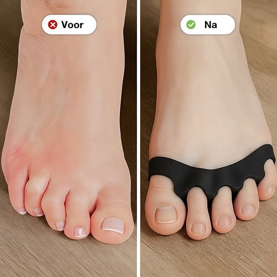 Alyze Teenspreider - 2 Stuks - Hallux valgus teenafstandhouder - Teenbeschermer - Tenenspreiders - Hamertenen-afstandhouder - Grote teen - Persoonlijke Verzorging