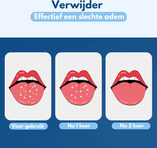 VAIVE Tongschraper Set - Tongue Scraper - Tong Schraper - Tongschrapers - Reiniger - Mondverzorging - tongborstel