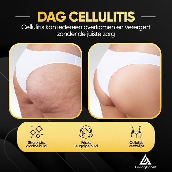 LivingBoost® - Elektrische Cellulite Massage Apparaat - Inclusief Gua Sha - 12 Standen en Temperaturen - Full Body - Cupping Cups Set Massage - Cellulite Cups - Anti Cellulitis