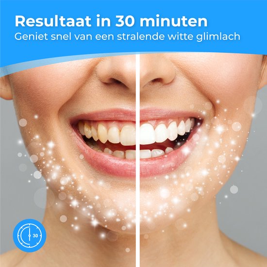 Nuvance - Tandenbleekstrips - Tanden Bleekstrips - Tandenbleekset - Tanden Bleken - met 0% Peroxide - Witte Tanden - 14 Sets/28 Strips
