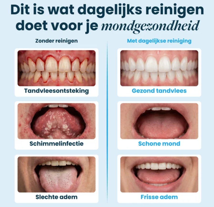 DreamCare UltraPod - Ultrasone Reiniger - Wit - 5 Tijdsstanden, Reinigt in 60 Seconden