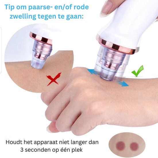 Elektrische Mee-eter Verwijderaar – Blackhead Remover met Vacuum – Gezichtsverzorging Set