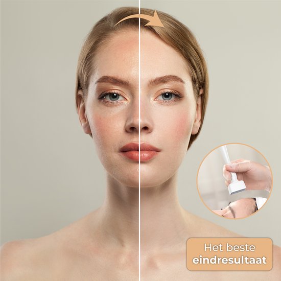 Nuvance - Dermastamp - Verstelbaar tussen 0,1mm en 3mm - Derma Stamp - 140 Naalden - Microneedling - Dermaroller - voor Huidverzorging, Haargroei en Baardgroei