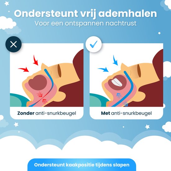 DreamCare Anti Snurk Beugel - Verstelbaar - Bpa vrij