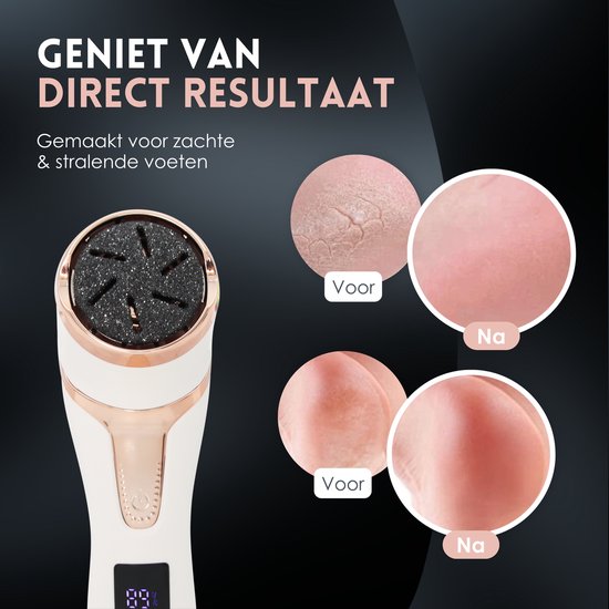 Beeperfect® Elektrische Eeltverwijderaar met Stofzuigsysteem - Voetvijl - Eeltvijl - IPX7 Waterdicht - Inclusief 6 Eeltschijven - Incl. pedicure set