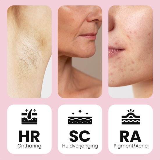 Leafline® IPL Laser Ontharingsapparaat – Epileerapparaat Dames – Pijnloos Met Ice Cooling – Voor Permanente Ontharing Van Alle Lichaamsdelen – 999.999 Flitsen – Thuisgebruik