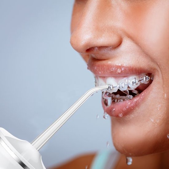 Nexxt Waterflosser – Diep Reiniging Tussen Tanden – Voor Gezond Tandvlees & Frisse Adem