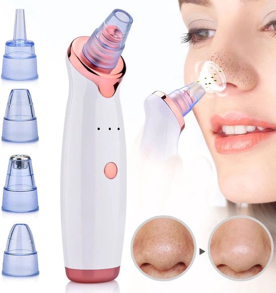 Elektrische Mee-eter Verwijderaar – Blackhead Remover met Vacuum – Gezichtsverzorging Set