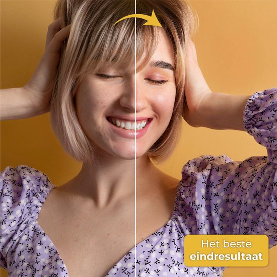 Nuvance - Dermaroller - 540 Micro Naalden van 0.5mm - Incl. eBook - Derma Roller voor Huidverzorging - Baardroller voor Haargroei - Steriel Verpakt
