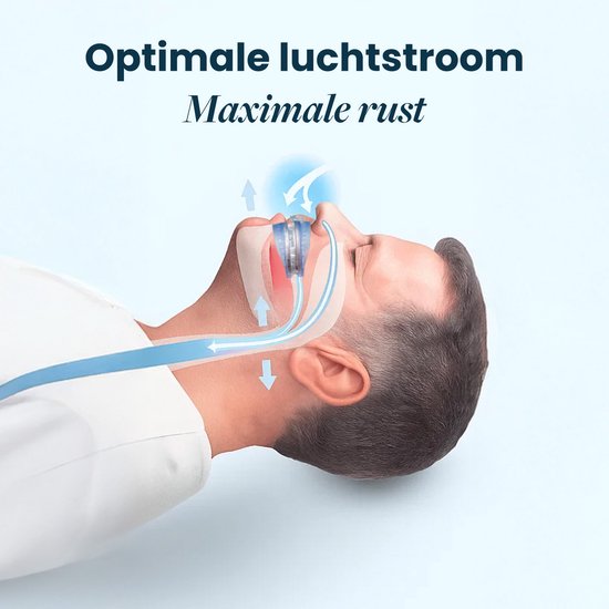 DreamCare Anti-Snurk Beugel Comfort - Snurkbeugel - Anti Snurk - Verstelbaar - Snurkbeugels - Anti Snurk Producten - Knarsbitje