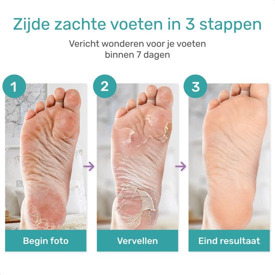 Soft & Silky Eeltsokken - 2 pack - Foot peel mask - Eeltverwijderaar voor voeten - Voet - Masker - Eelt - Vijl - Rasp - crème vervanger - Peeling - Lavendel -