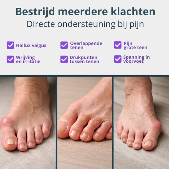 VeryGoods™ Hallux Valgus Teencorrector - Teenspreider Grote teen - 2 Stuks - Teenbeschermer - Hamerteen - Tenenspreiders