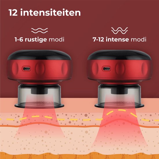 Nuvance - Elektrisch Cellulite Massage Apparaat - 12 Standen en Temperaturen - Volledig Lichaam - Cupping Cups Set Massage - Cellulite Cups - Hijama Cups - Anti Cellulitis