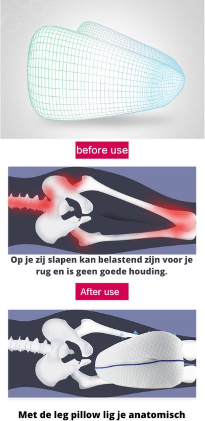 Dreamolino Leg Pillow|Ergonomisch knie- en beenkussen|Hoogwaardig memoryfoam|Creëert het optimale ligcomfort voor zijslapers|Voor meer comfort|Orthopedisch knie kussen