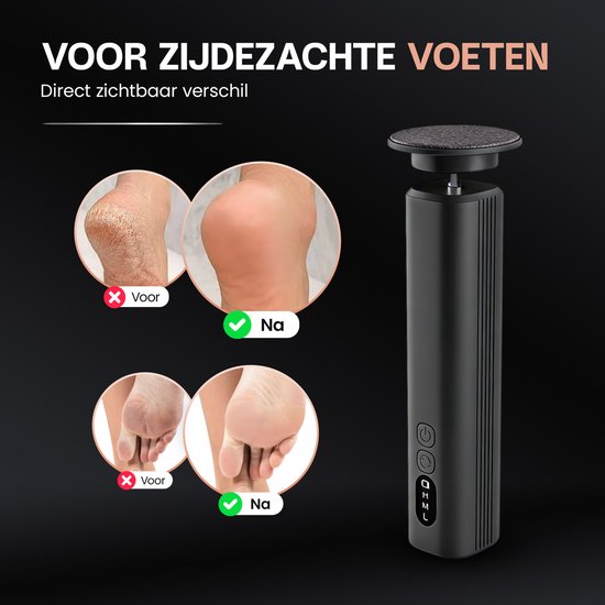 Beeperfect® Elektrische Eeltverwijderaar Pro - Voetvijl - Eeltvijl - Draadloos - Oplaadbaar - Met oplaadstation - 60 Schuurvellen - Zwart