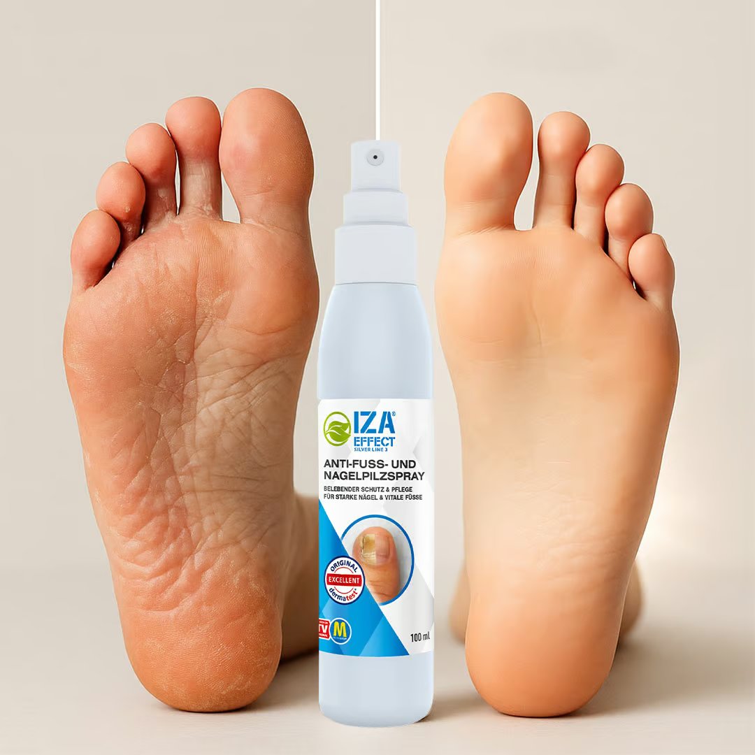IZA Effect Voetschimmel- en Nagelsprayset - Snelle Toepassing - Zichtbaar Resultaat - 1+1 Gratis