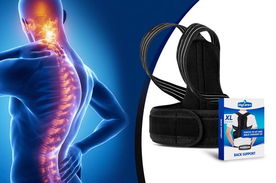 Mycare+ Rugband - Maat XL - Postuur Corrector - Tegen Rugklachten - Wasbaar - Mannen en Vrouwen