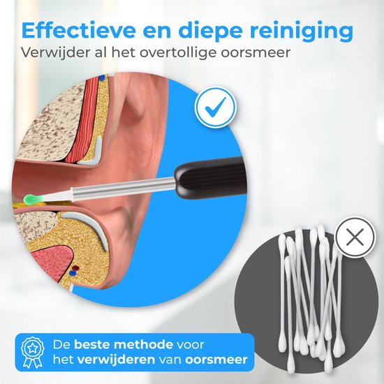Nuvance - Oorsmeer Verwijderaar met Camera App - Oorreiniger - Oor Schoonmaken Set - Oorspuit - Earscratcher - Incl. Reinigingsset