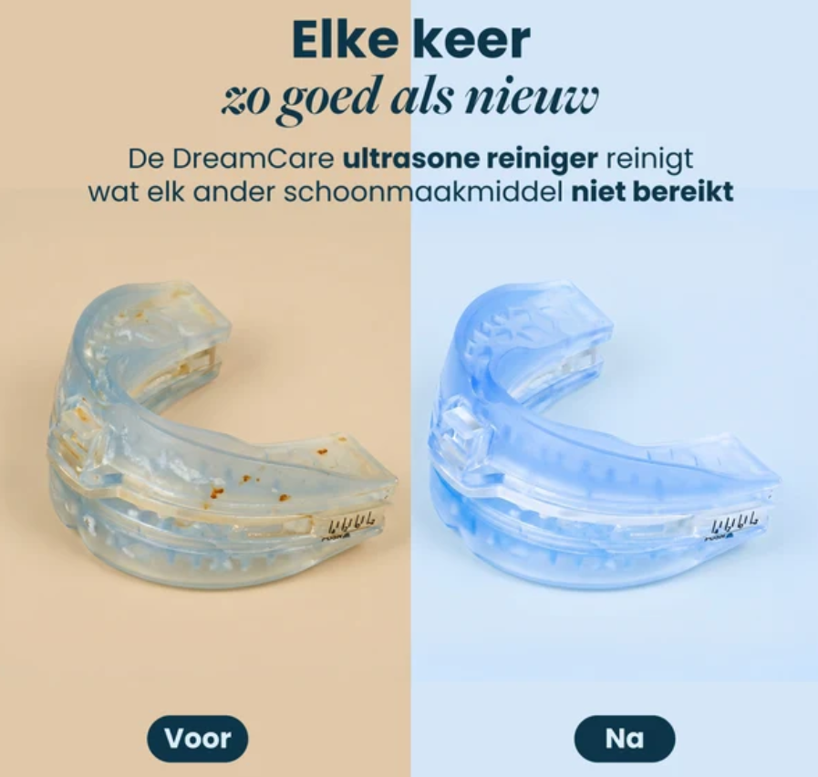 DreamCare UltraPod - Ultrasone Reiniger - Wit - 5 Tijdsstanden, Reinigt in 60 Seconden