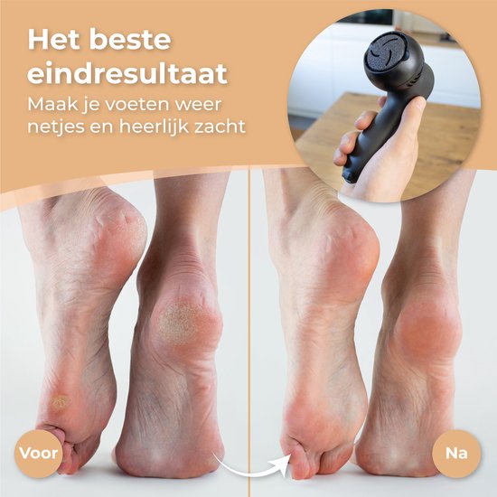 Nuvance - Elektrische Eeltverwijderaar - Incl. 3 Eeltschijven - Eeltverwijderaars Elektrisch - Professionele Eelt Verwijderaar Set, 10 Delige Pedicureset - Voetvijl - Usb Oplaadbaar
