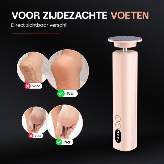 Beeperfect® Elektrische Eeltverwijderaar Pro - Voetvijl - Eeltvijl - 60 Eeltschijven en 20 Schuurrollen - Met Oplaadstation