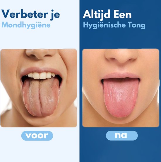 VAIVE Tongschraper Set - Tongue Scraper - Tong Schraper - Tongschrapers - Reiniger - Mondverzorging - tongborstel